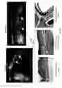 Fig. 37 - System, method and computer-accessible medium for in-vivo tissue ablation and/or damage
