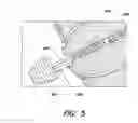Fig. 06 - Fundus bumper mechanical reference for easier mechanism deployment