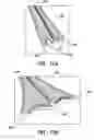 Fig. 12 - Fundus bumper mechanical reference for easier mechanism deployment