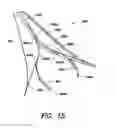 Fig. 16 - Fundus bumper mechanical reference for easier mechanism deployment