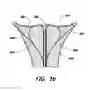 Fig. 17 - Fundus bumper mechanical reference for easier mechanism deployment