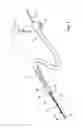 Fig. 02 - Feedback systems and methods for renal denervation utilizing balloon catheter