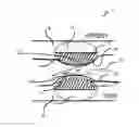 Fig. 01 - DUAL CATHETER ABLATION SYSTEM