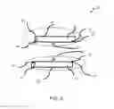 Fig. 03 - DUAL CATHETER ABLATION SYSTEM