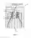 Fig. 08 - DUAL CATHETER ABLATION SYSTEM