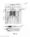 Fig. 09 - DUAL CATHETER ABLATION SYSTEM