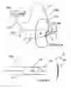 Fig. 04 - Methods for monopolar renal neuromodulation
