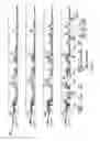Fig. 07 - Laser catheter with use of determined material type in vascular system in ablation of material