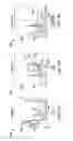 Fig. 08 - Laser catheter with use of determined material type in vascular system in ablation of material