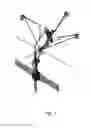 Fig. 06 - Device and methods of improving laparoscopic surgery