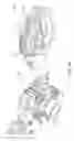 Fig. 11 - Configurable robotic surgical system with virtual rail and flexible endoscope