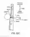 Fig. 32 - Preloaded surgical instrument interface