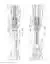 Fig. 67 - Surgical end effectors having angled tissue-contacting surfaces