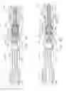 Fig. 68 - Surgical end effectors having angled tissue-contacting surfaces