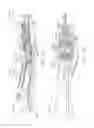 Fig. 70 - Surgical end effectors having angled tissue-contacting surfaces