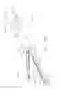 Fig. 78 - Surgical end effectors having angled tissue-contacting surfaces