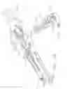 Fig. 80 - Surgical end effectors having angled tissue-contacting surfaces