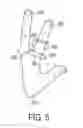 Fig. 06 - Finger-worn oral procedure apparatus and method
