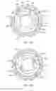Fig. 07 - Reversible multiple use disposable torque limiting device