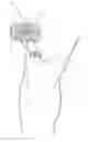 Fig. 01 - Surgical Site Indicator