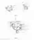 Fig. 03 - Medical pendant lifting system