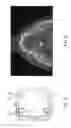 Fig. 07 - Disposable surgical intervention guides, methods, and kits