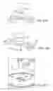 Fig. 17 - Disposable surgical intervention guides, methods, and kits