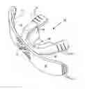 Fig. 01 - Intra-oral device
