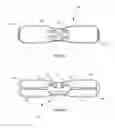 Fig. 03 - Intra-oral device