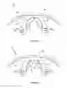 Fig. 05 - Intra-oral device