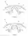 Fig. 05 - Method of use for INTRA-ORAL DEVICE