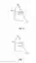 Fig. 06 - Dental wire attachment