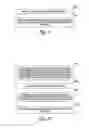 Fig. 08 - Dental wire attachment