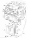 Fig. 04 - SELF-LIGATING ORTHODONTIC BRACKET AND METHOD OF MAKING SAME