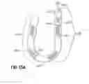 Fig. 17 - SELF-LIGATING ORTHODONTIC BRACKET AND METHOD OF MAKING SAME