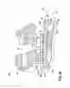 Fig. 24 - SELF-LIGATING ORTHODONTIC BRACKET AND METHOD OF MAKING SAME