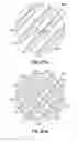 Fig. 32 - SELF-LIGATING ORTHODONTIC BRACKET AND METHOD OF MAKING SAME