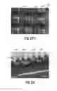Fig. 33 - SELF-LIGATING ORTHODONTIC BRACKET AND METHOD OF MAKING SAME