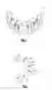 Fig. 02 - Dental restoration system for installing bridge prostheses on mini dental implants