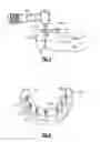 Fig. 03 - Dental restoration system for installing bridge prostheses on mini dental implants