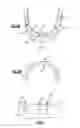 Fig. 04 - Dental restoration system for installing bridge prostheses on mini dental implants