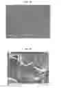 Fig. 11 - Titanium nano-scale etching on an implant surface