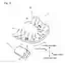 Fig. 04 - Impression tray