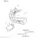 Fig. 07 - Impression tray