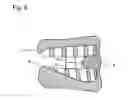 Fig. 09 - Impression tray