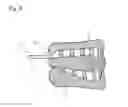 Fig. 10 - Impression tray