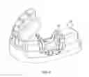 Fig. 06 - DISPOSABLE SURGICAL INTERVENTION GUIDES, METHODS, AND KITS