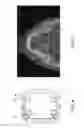 Fig. 07 - DISPOSABLE SURGICAL INTERVENTION GUIDES, METHODS, AND KITS