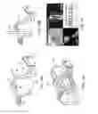 Fig. 11 - DISPOSABLE SURGICAL INTERVENTION GUIDES, METHODS, AND KITS