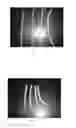 Fig. 02 - High-strength biological scaffold material and preparation method thereof